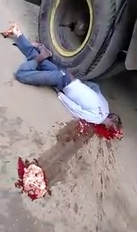 Loses Brain: Old man crushed by Truck 