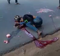 BRAIN RIPPED Worst accident ever