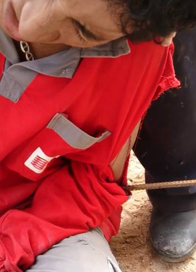 Construction worker gets a long steel bar embedded in his Arm 