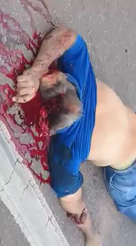 Motorcyclist With Destroyed Head after Accident with Truck 