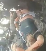 Pretty Girl Accident