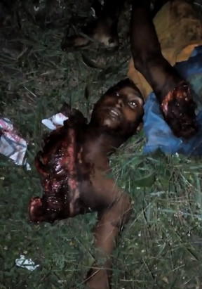 Dismembered in accident ...Brutal Gore 