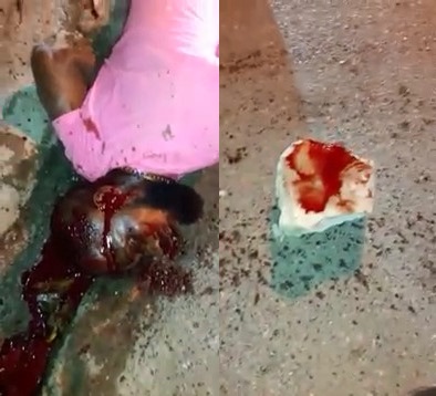 Haitian Agonizes after Being Beaten in the Head with a Giant Rock 