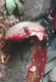 Woman Has Skull Cracked by Truck in Cikarang, West Java, Indonesia