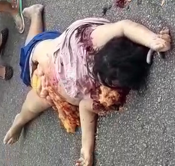 Woman dies with guts exposed