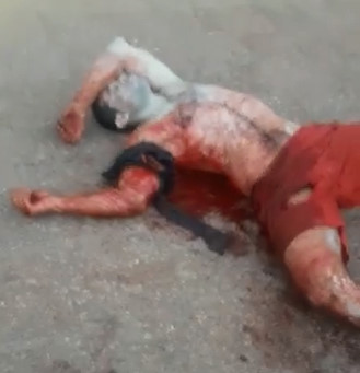 Stabbed man suffers near the hospital entrance