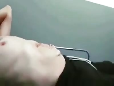 WTF ! Giant abdominal hernia