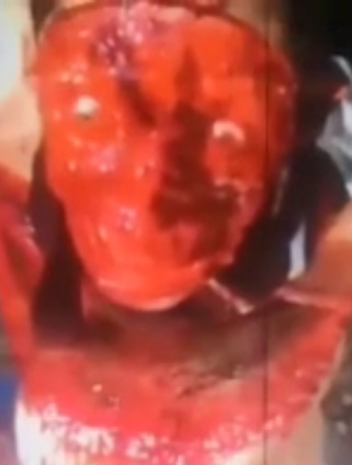 Blood Collection # 4