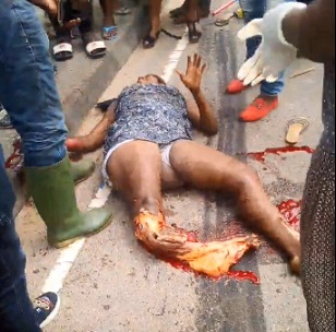 At The Moment No Pain Due To Shock