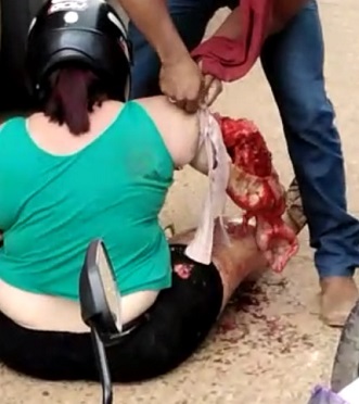 Damn! One of Those Times You Don't Want to be Alive.