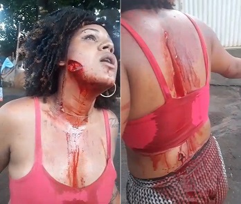 Cute Chick Gets Slashed In Vile Street Fight