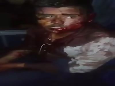 Thief after receiving punishment