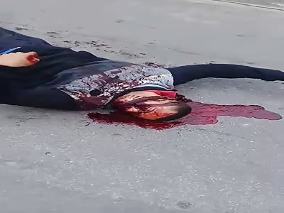 SHOCKING: bleeding suicider is alive with a bullet in the head