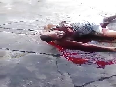 Dying in a Blood Puddle....