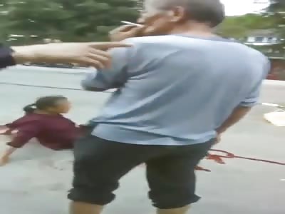 Shocking. woman with broken leg after accident