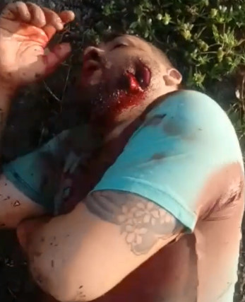 Dying Robber with Extra Hole in the Mouth