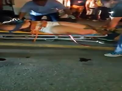 Accident on the road leaves several injured with breaks