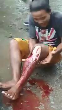 OH HELL.....Poor Man with Nasty Leg Break 