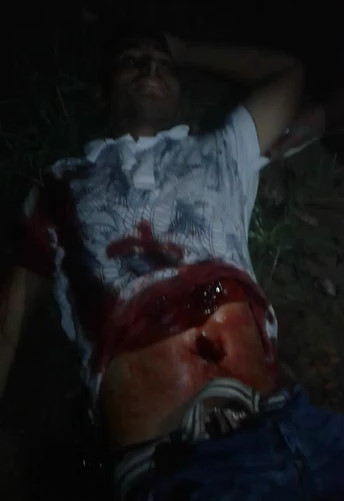 Stabbed man is in shock and can not say a thing