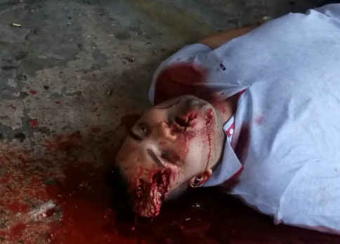 Cranial cavity emptied due to a bullet with brains strewn on the ground.