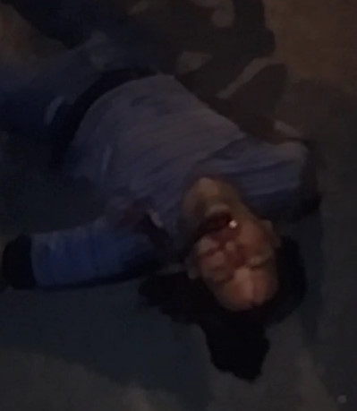 Hard to Watch Scene of Man Spitting up Blood and in Shock Dying 