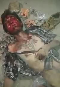 Thief was brutally beaten in the Head Dying in Agony