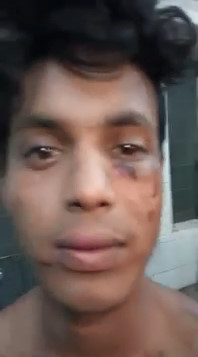 Aftermath from the video: Young Crying Thief Tied to a Tree Brutally Beaten in India (uploaded by thekiddd)