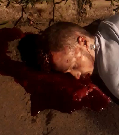 Boy Shot in the Brain Lays in a Pool of Blood Agonizing on the Sidewalk