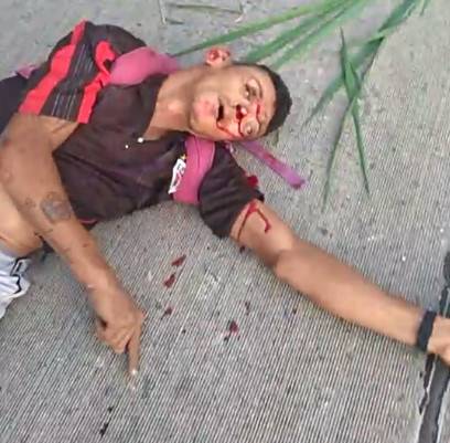 Motorcyclist Dies in Accident [AFTERMATH]