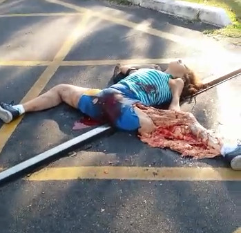 Woman's Leg Ripped to Shreds From Terrible Accident