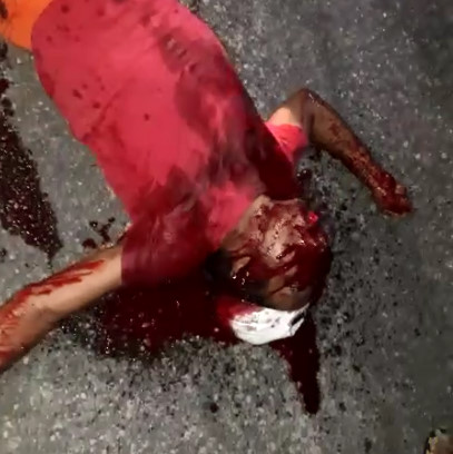 Man Shot in the Head Takes his Last Dramatic Last Breathe 