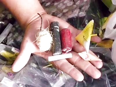 Morons Hand Destroyed From Homemade Firework