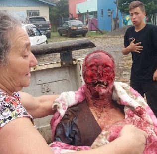 FUCKING BRUTAL: A Pitbull Did this to Him {Picture Set}