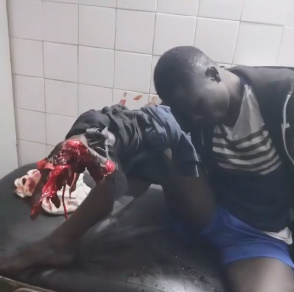 DAMN! Grenade Explodes in Protestor's Hand