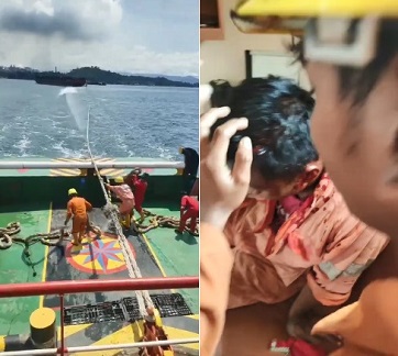 DAMN! Work Accident the Boat Edition