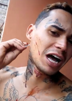 Attention Whore Cuts Himself On Camera