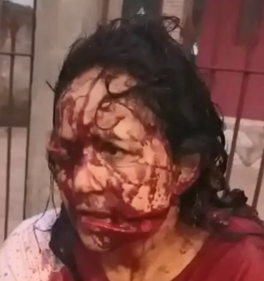 Woman Hacked Up Like a Piece of Raw Pork