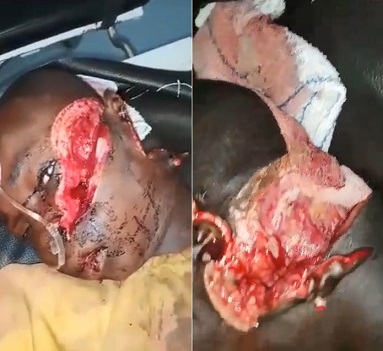 HOLY SHIT! When it Sucks to be Awake