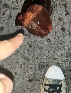 Heart Ripped Out And Still Beating