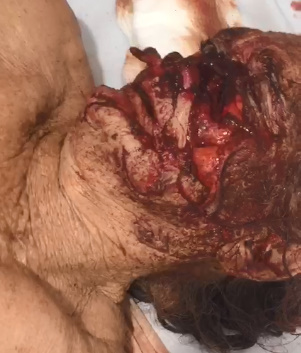 HOLY SHIT! A Pitbull Did this to Her