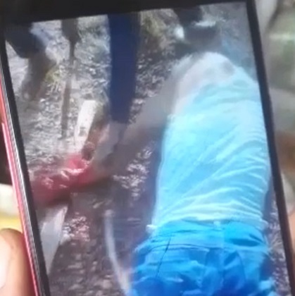 Favela Thief Gets His Hand Chopped Off with a Machete