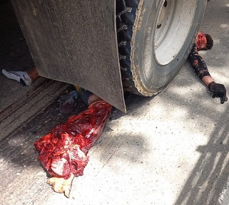 GRAPHIC MOPED CRASH AFTERMATH 