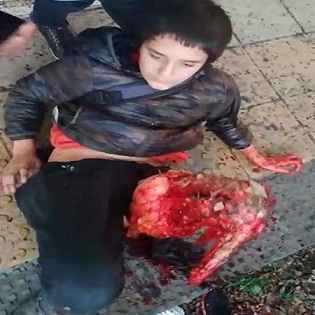 Poor Dude Looking What Train Did To Him In Shock