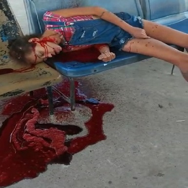 Homicide: Slim Woman Dies In Pool Of Blood.