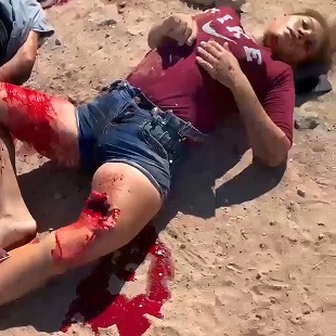 In A Couple Of Minutes She Will Meet With God