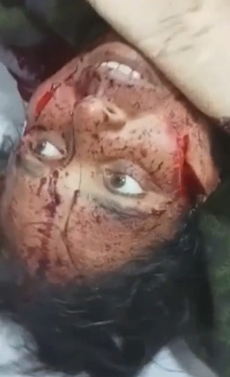 Woman Died Shortly After Cruel BF Chopped Off Her Boobs , Ear And Arms With A Sickle