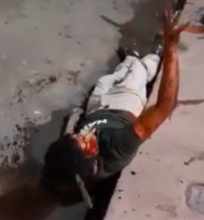 Lunatic BURIES Knife In Man's Skull