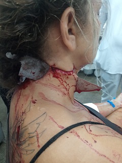 Disturbing Footage Of Woman Stabbed By Ex Husband With A Knife Blade Stuck In The Neck