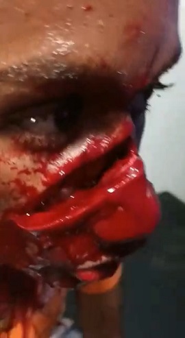 He Definitely Regrets Starting The Knife Fight In Local Bar