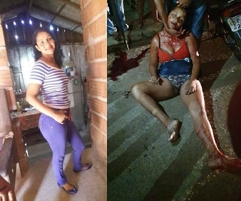 In A Couple Of Seconds She Will Meet With God